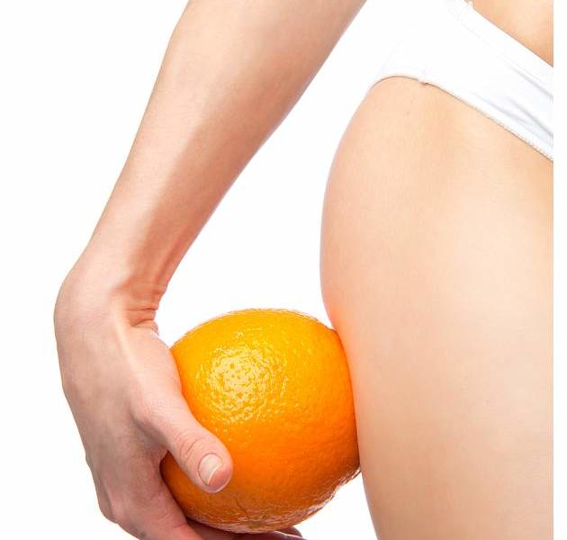 celulit-skorka-pomaranczowa-nogi Sprawdzone metody walki ze skórką pomarańczową