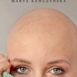 ALOPECJANKI – historie łysych kobiet
