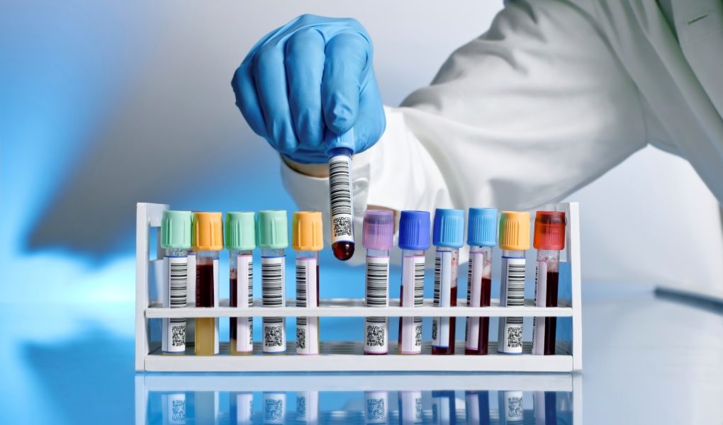 Badania laboratoryjne dla kobiet w ciąży