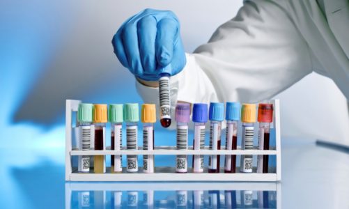 Badania laboratoryjne dla kobiet w ciąży