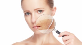 Przebarwienia to przeszłość – sprawdź, jak sobie z nimi poradzić