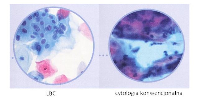 porownanie_cytologii-001-2014-04-23-_-17_58_38-751