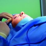 Jak odmłodzić wygląd skóry wokół oczu?