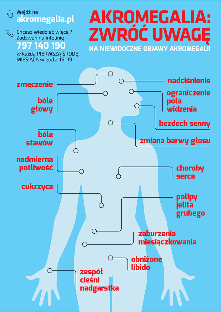Infografika(1) Akromegalia: jak rozpoznać chorobę?
